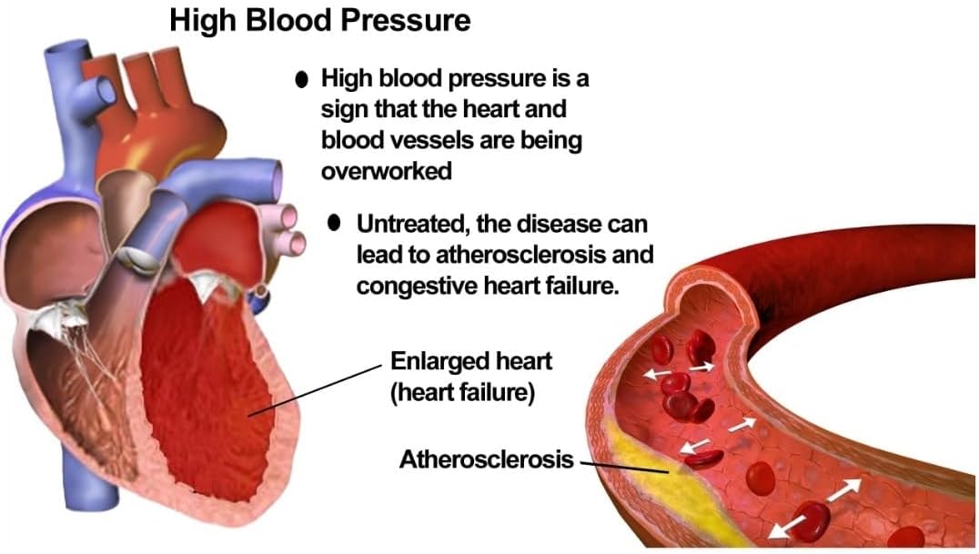 Pressure Guard - Natural Herbal Supplement for Healthy Blood Pressure Support, 180 Vegan Capsules - görsel 3