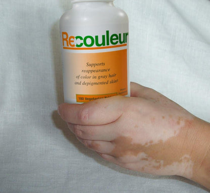 Recouleur Vitiligo Vitamin and Mineral Supplement for Normal Skin Pigmentation - 6 Month Supply
