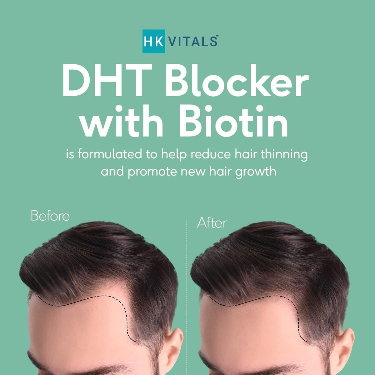 HK Vitals DHT Blocker with Biotin - 60 Tablets - görsel 3