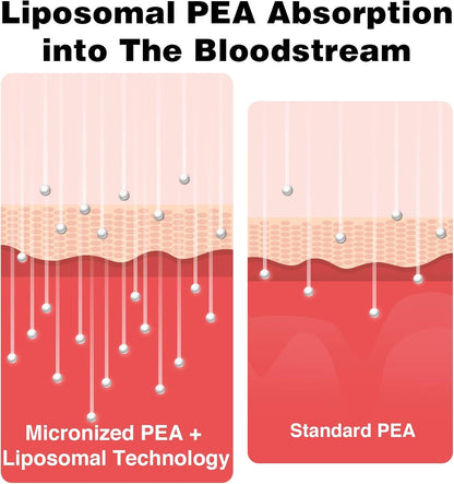 Liposomal Palmitoylethanolamide 1000 mg + Luteolin 100 mg, Micronised PEA 99% Highly Purified – Enhanced Absorption and Bioavailability, 120 Softgels