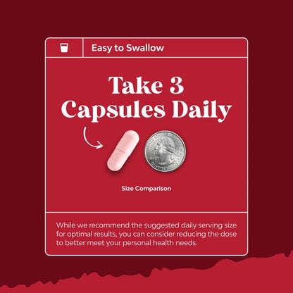 Extra Strength Tart Cherry Capsules - Tart Cherry Extract for Uric Acid and Kidney Support - Fruit Extract Supplement for Urinary Tract Health & Joint Care - 120 Capsules