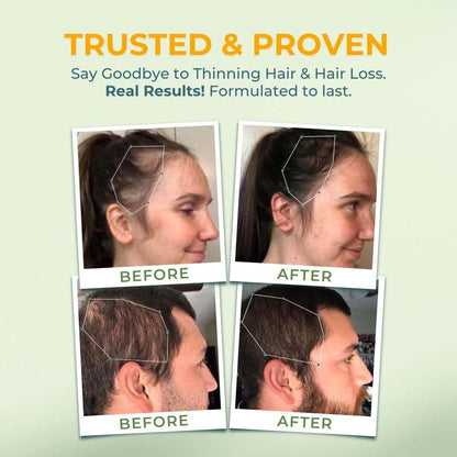 VITAL NUTRITIVE Vital Hair Complex - Hair Growth Supplement with Biotin and Vitamin B