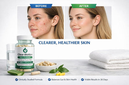 Clear-Biotic Acne Capsules – Probiotic Acne Supplements for Teens and Adults, Hormonal Acne Vitamins, Gut Health for Clear Skin, Non-GMO (60 Capsules)