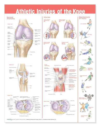 Athletic Injuries of the Knee Anatomical Chart