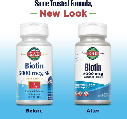 KAL Biotin 5000 TR Tablets, 5000 mcg, 60 Count