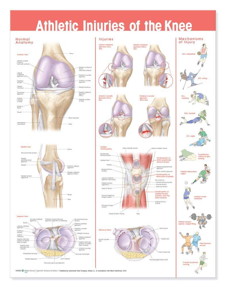 Athletic Injuries of the Knee Anatomical Chart - görsel 1