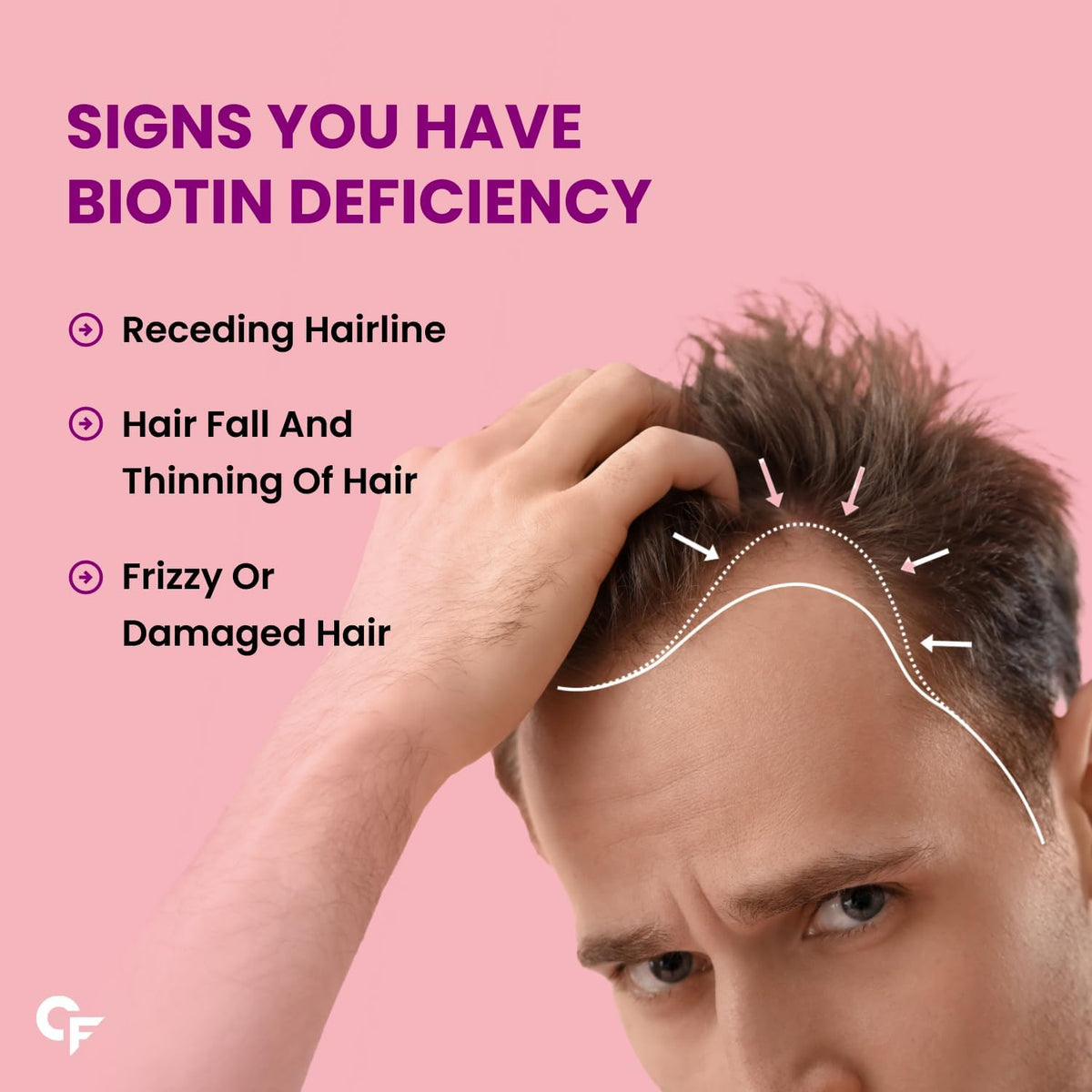 Carbamide Forte Biotin 10000mcg (High Potency) Vegetarian Tablets – For Hair Growth, Glowing Skin and Strong Nails – 120 Tablets - görsel 4