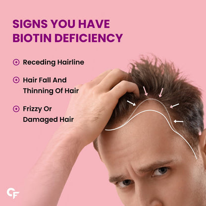 Carbamide Forte Biotin 10000mcg (High Potency) Vegetarian Tablets – For Hair Growth, Glowing Skin and Strong Nails – 120 Tablets
