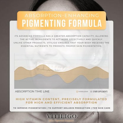 Dermawonder Vitiligo Capsules
