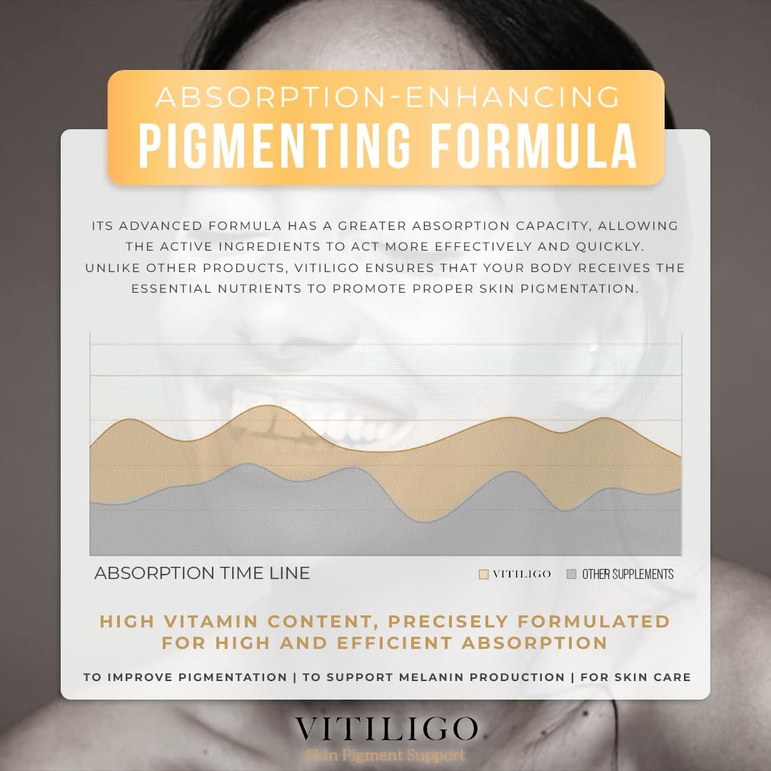 Dermawonder Vitiligo Capsules – 60 Capsules | Skin Pigmentation Support - görsel 4