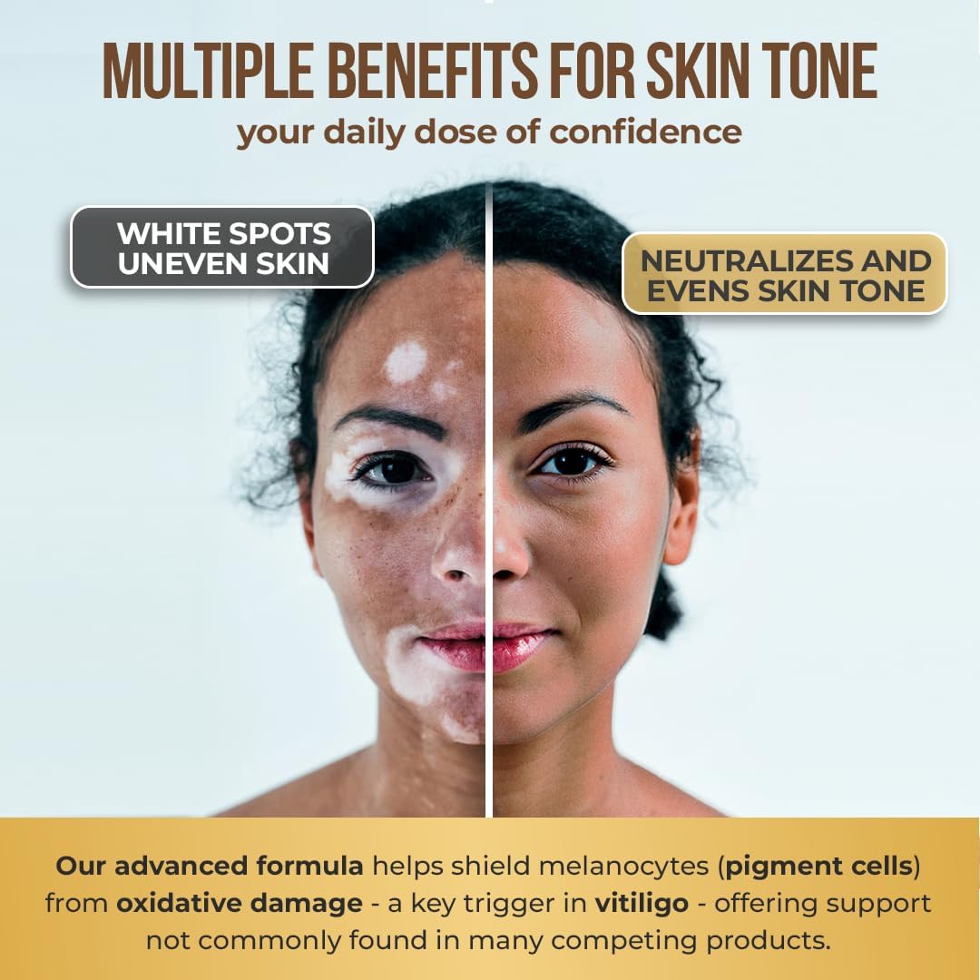 Dermawonder Vitiligo Capsules – Skin Pigmentation Support (60 Capsules) - görsel 6