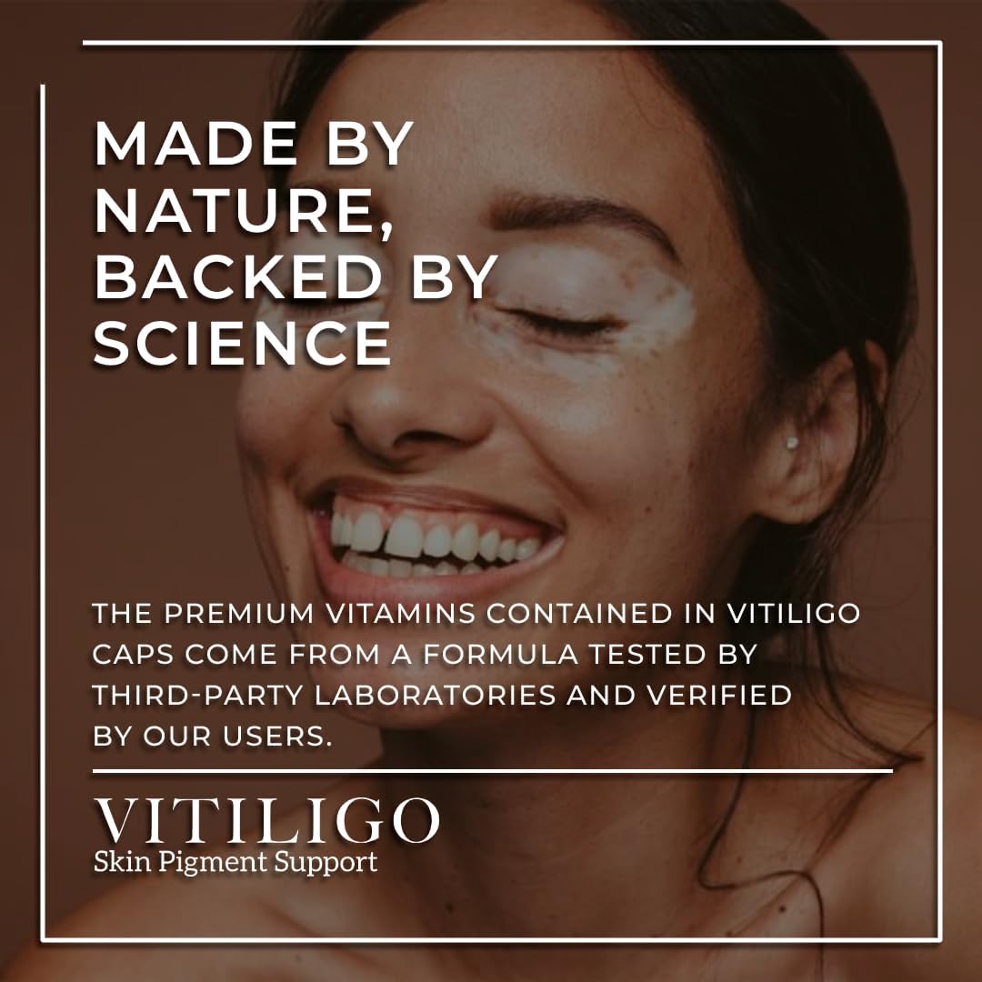 Dermawonder Vitiligo Capsules - görsel 2