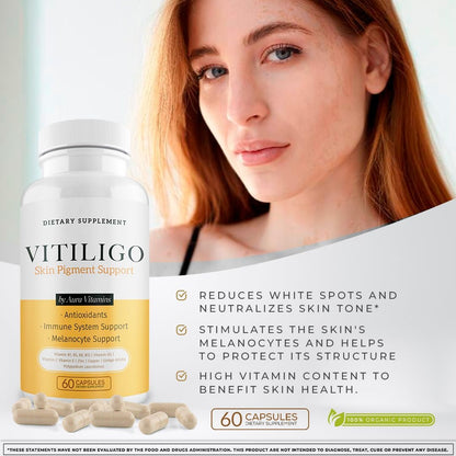 Dermawonder Vitiligo Capsules – 60 Capsules | Skin Pigmentation Support