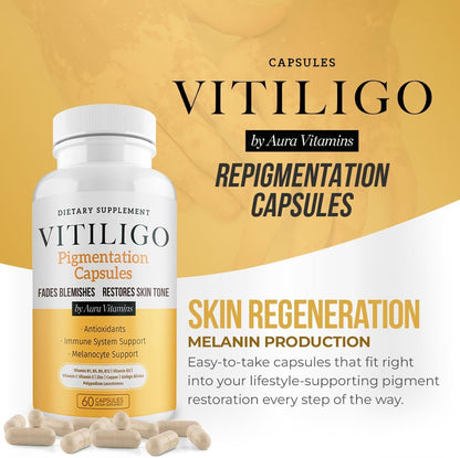 Dermawonder Vitiligo Capsules – Skin Pigmentation Support (60 Capsules)