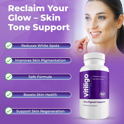 AURA VITAMINS Vitiligo Capsules (60 Capsules)