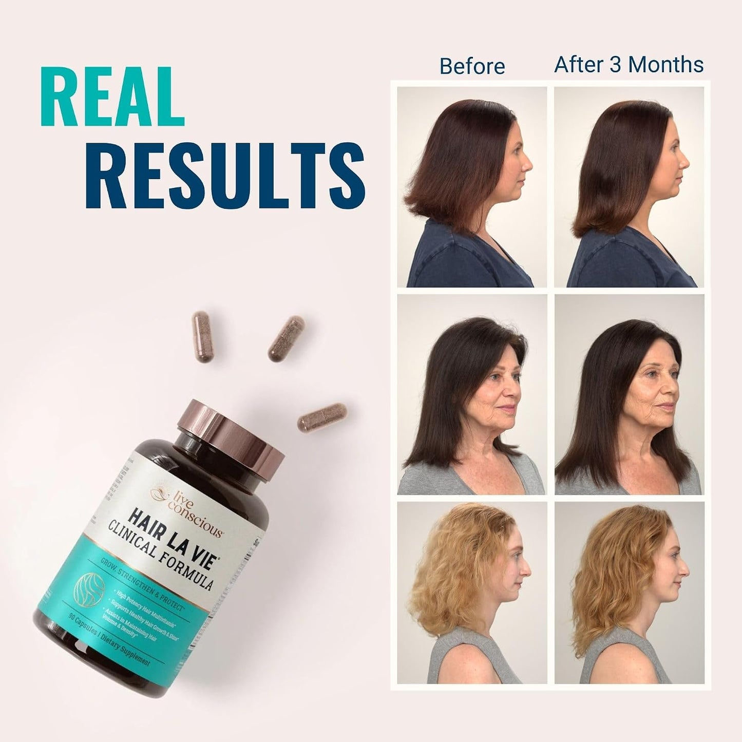Hair La Vie Live Conscious Clinical Formula Hair Supplements with Biotin and Saw Palmetto - For Healthy Hair and General Wellbeing (Pack of 2) - görsel 3