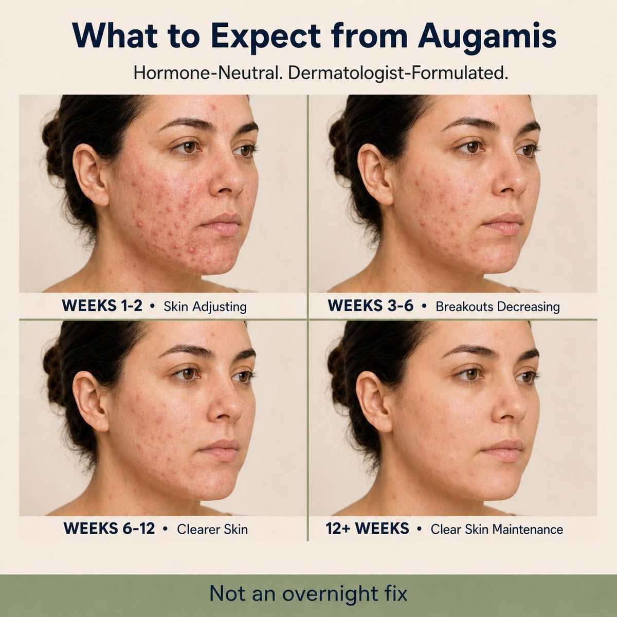 Augamis Hormonal Acne Support for Women – DIM-Free Clear Skin Supplement - görsel 8
