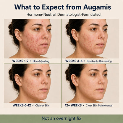 Augamis Hormonal Acne Support for Women – DIM-Free Clear Skin Supplement