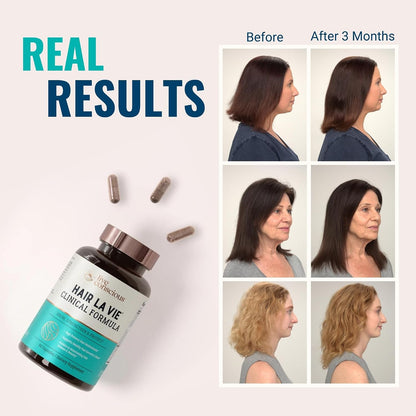 Hair La Vie Clinical Formula Hair Growth Vitamins – with Biotin, Collagen & Saw Palmetto – Image 3