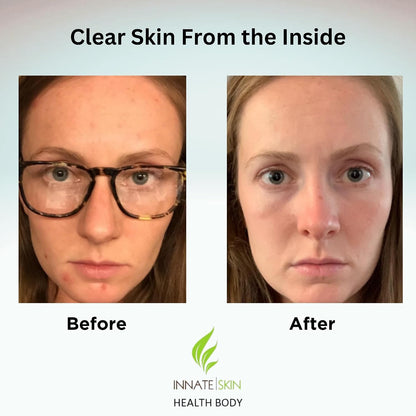 Clear Skin Acne Vitamin System - 60 Capsules (2-Pack)