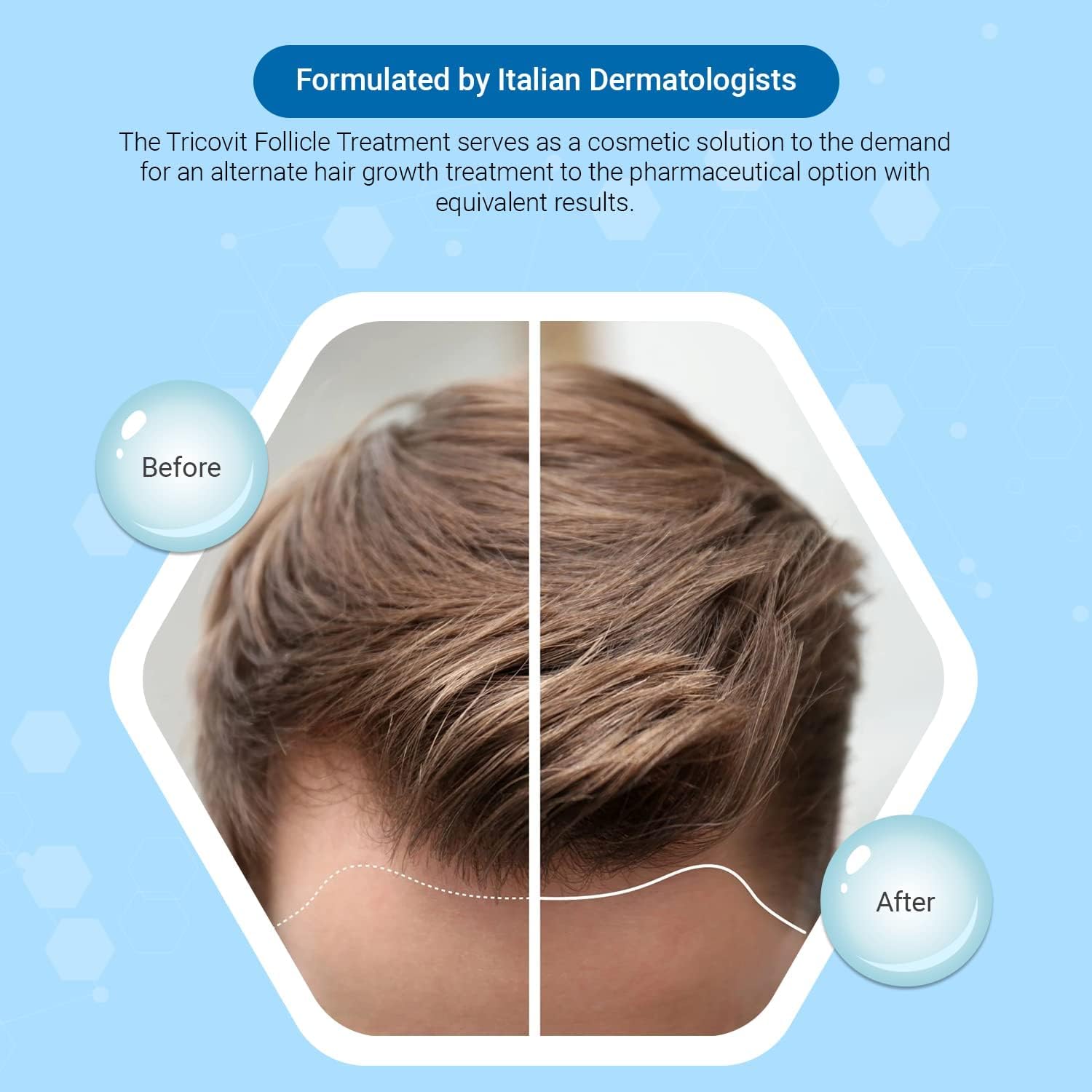 Tricovit Hair & Nail Supplement: Amino Acids, Minerals & Antioxidants - 60 Tablets - görsel 2