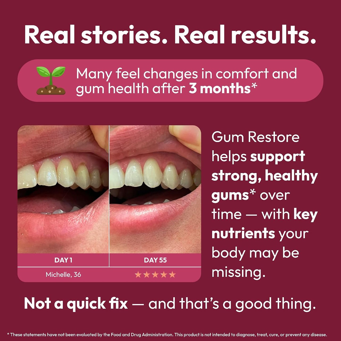 Strong Jaw Gum Restore – Gum Support for Receding Gums, Magnesium for Teeth, 180 Capsules - görsel 6