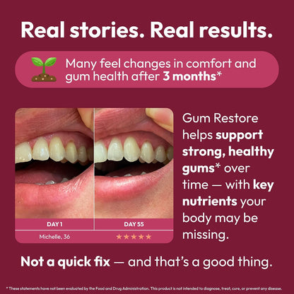 Strong Jaw Gum Restore – Gum Support for Receding Gums, Magnesium for Teeth, 180 Capsules
