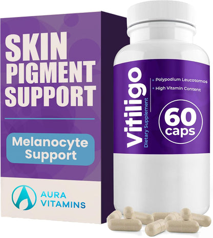 AURA VITAMINS Vitiligo Capsules (60 Capsules)