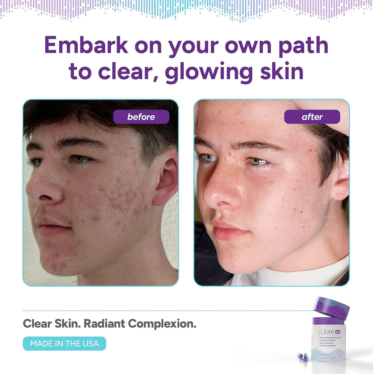 Clear Skin Supplement with Vegan Ceramides, Zinc, Vitamin D3, B6, Riboflavin & Thiamine | 30-Day Supply - görsel 3