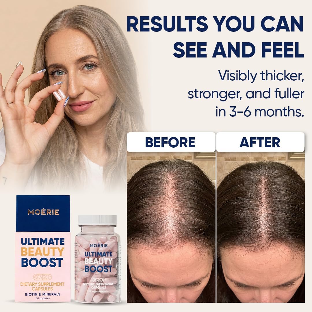 Moerie Ultimate Hair Boost Supplements - Hair, Skin & Nails Vitamins with Biotin & Minerals - 180 Capsules - görsel 4