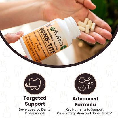 Bone-Tite Osseointegration Support Food Supplement – Key Vitamins, Minerals and Nutrients for Dental Implant Support (90 Tablets)