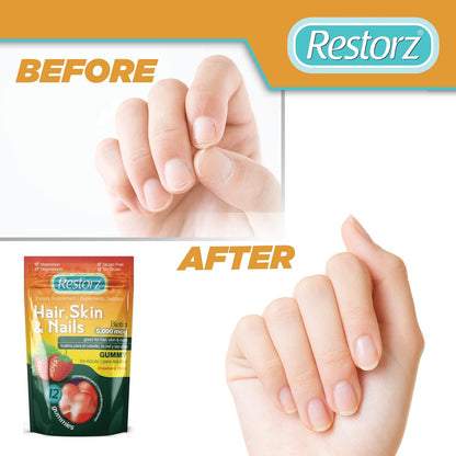 Restorz Hair, Skin, and Nails Biotin Gummy Vitamins, Strawberry Flavour (12-Pack)