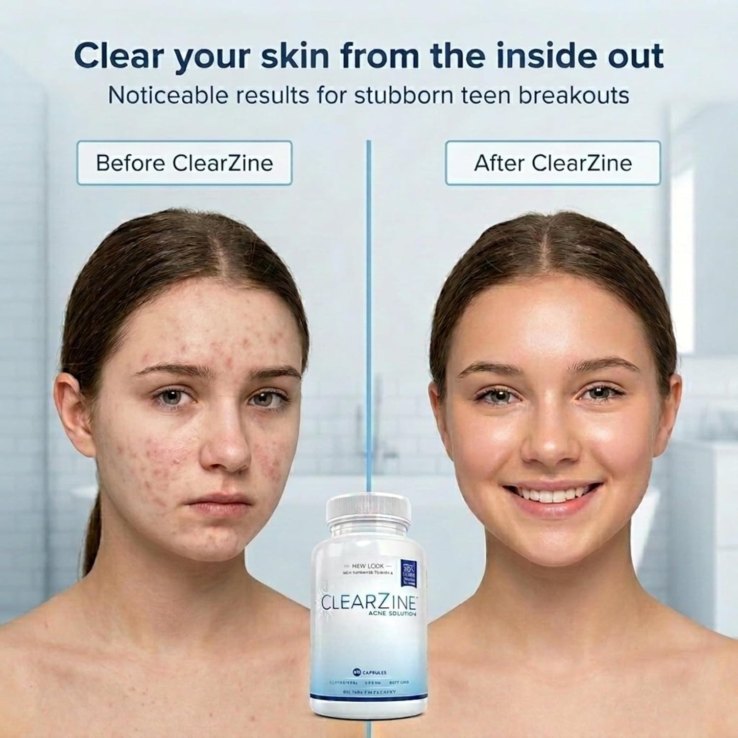 ClearZine Acne Pills – Hormonal & Cystic Acne Supplement for Teens & Adults (90 Capsules) - görsel 2