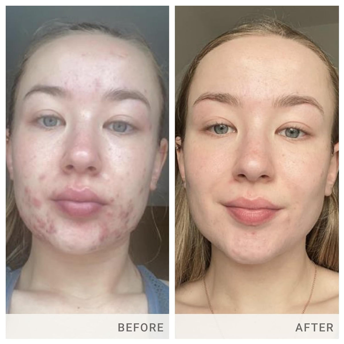 jane iredale Skin Accumax Nutritional Supplement - 90 Day Supply - görsel 5