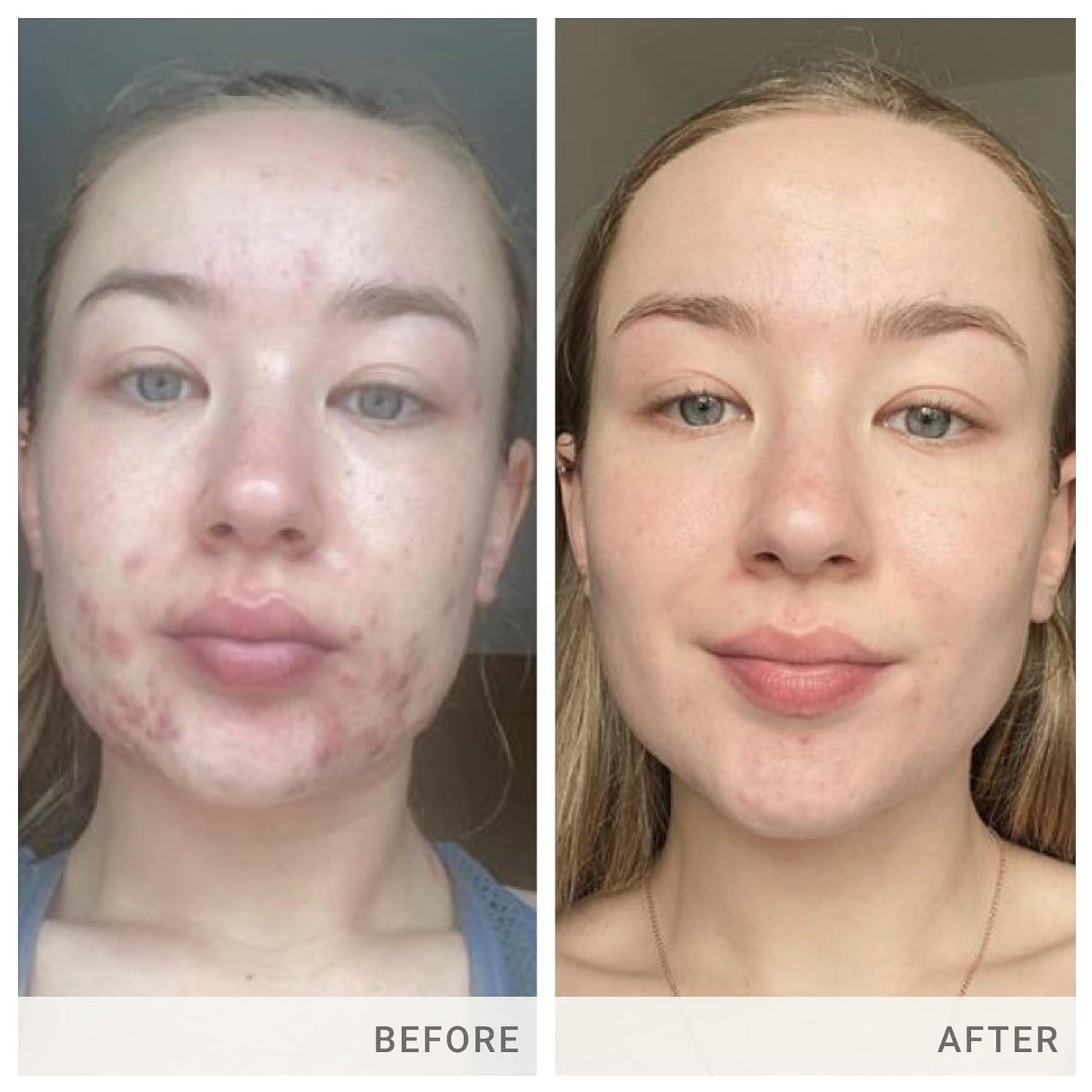jane iredale Advanced Nutrition Programme Skin Accumax Supplement - görsel 4