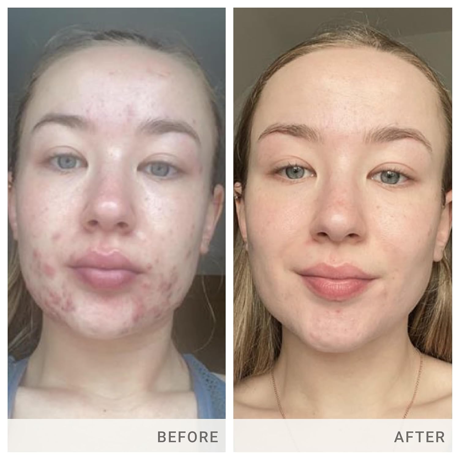 jane iredale Skin Accumax Nutritional Supplement Capsules Help Improve Acne & Support Healthy Skin Contains Vitamin A, C and E Vegan & Gluten-Free - görsel 4