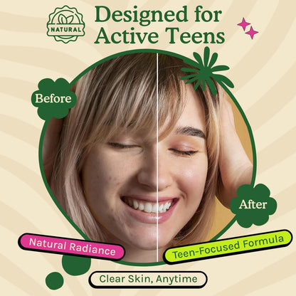 NURISR Acne Support Vitamins for Teens with A, B, C, E & Biotin - 60 Capsules