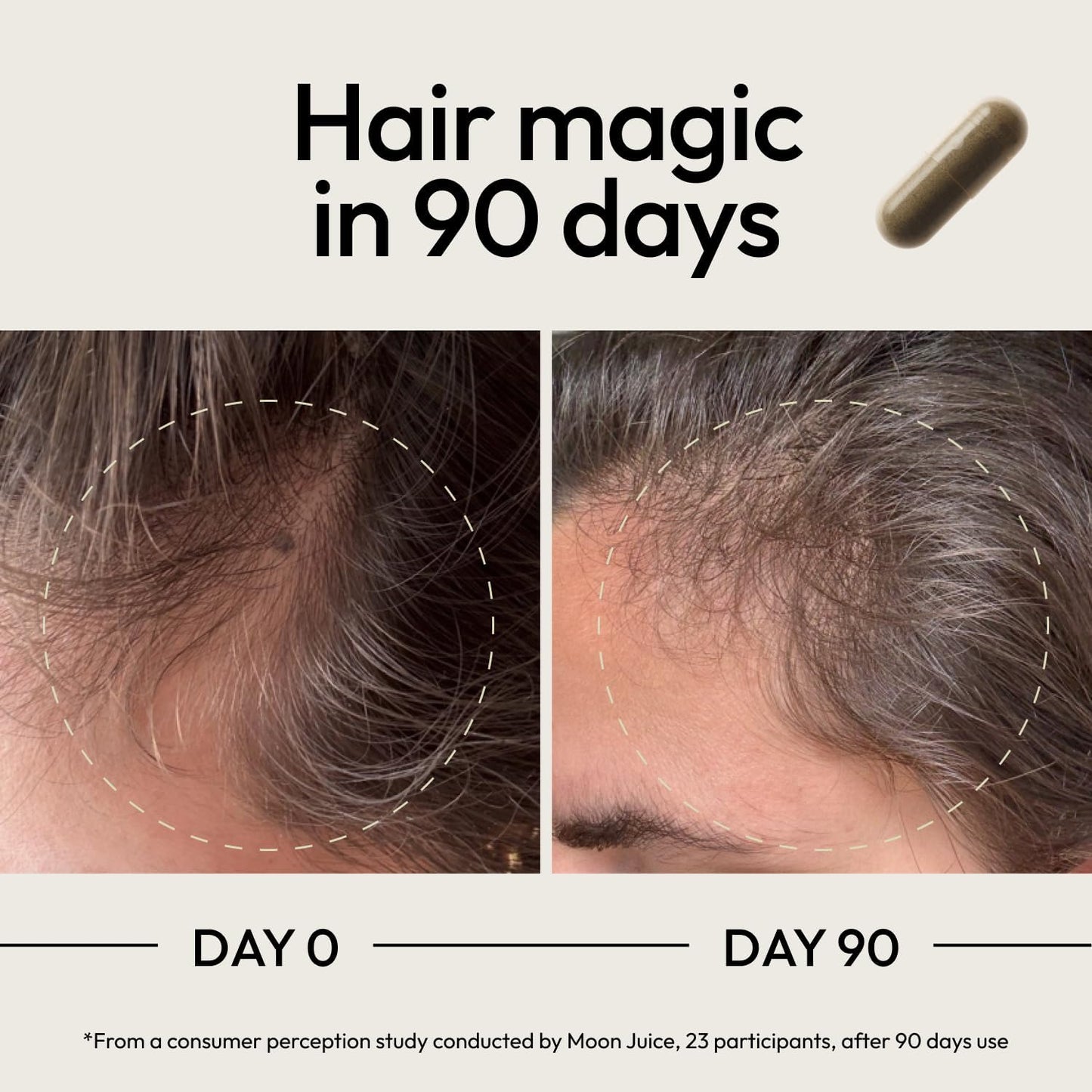 Moon Juice SuperHair Hair Growth Vitamins - görsel 4