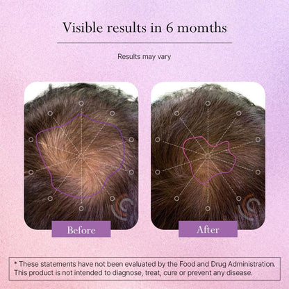Omvi Formulae, Hair Supplement with Biotin 20,000mcg, Collagen, Keratin, Vitamin A, C, D3 & B12, for Stronger-Looking Hair, Skin and Nails, Non-GM, Gluten-free, 120 Capsules