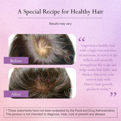 Omvi Formulae, Hair Supplement with Biotin 20,000mcg, Collagen, Keratin, Vitamin A, C, D3 & B12, for Stronger-Looking Hair, Skin and Nails, Non-GM, Gluten-free, 120 Capsules