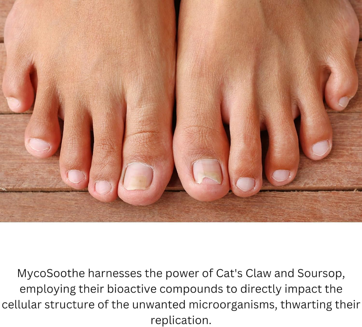 MycoSoothe Advanced Hair, Skin, Nail & Immunity Support Formula - 3 Pack Capsules - görsel 7