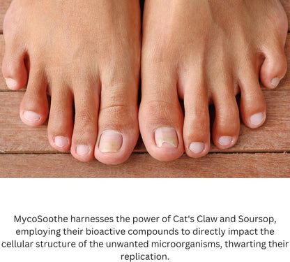 MycoSoothe Advanced Hair, Skin, Nail & Immunity Support Formula - 3 Pack Capsules