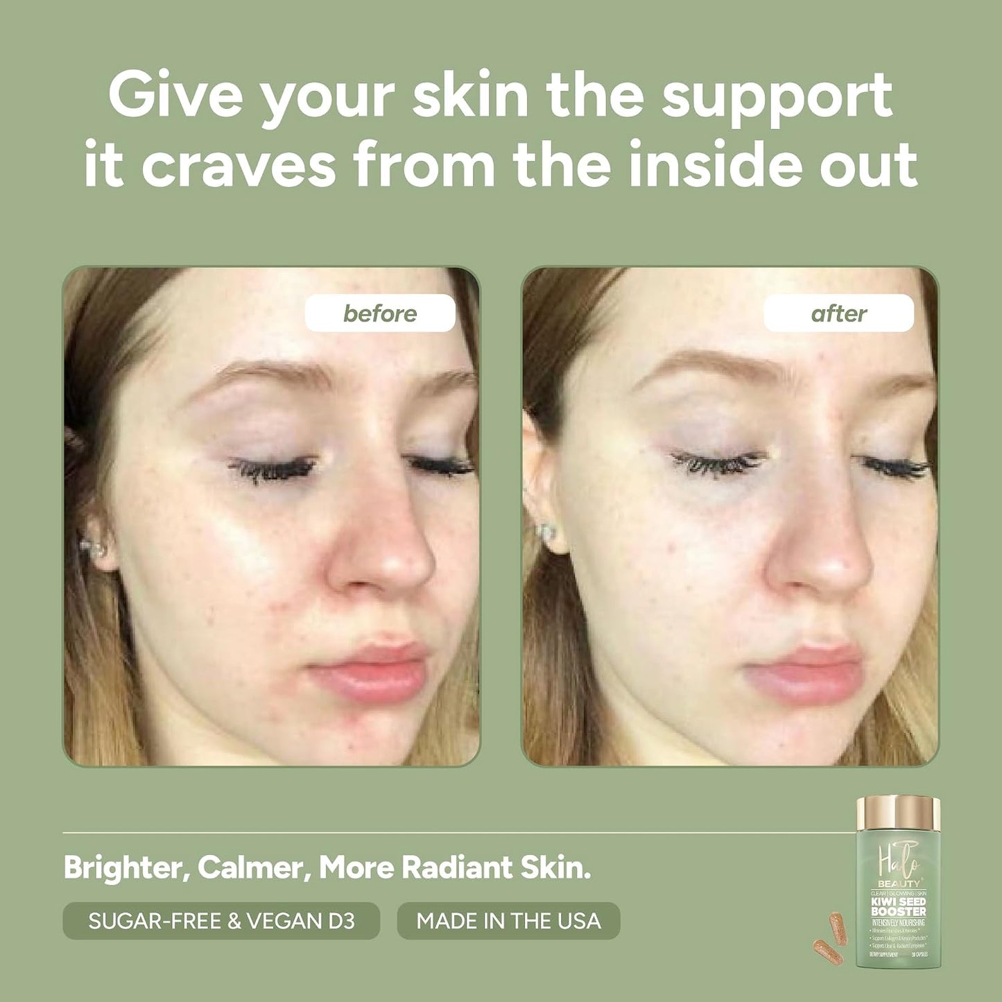 Halo Beauty Kiwi Seed Booster Skin Supplement Refill Pack | Anti-Ageing Hydration & Glowing Skin Support with Kiwi Seed, Vitamin C, D3 & Zinc | Vegan Collagen Support Capsules | 1-Month Supply - görsel 5