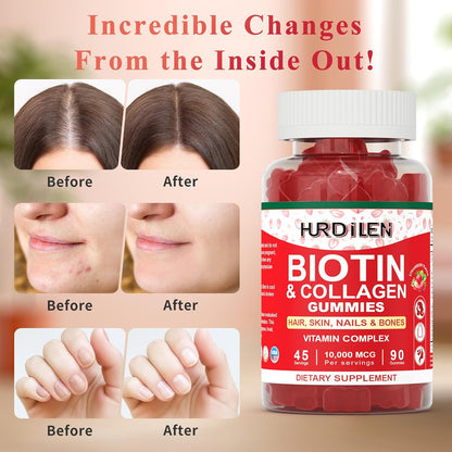 Hurdilen Hair, Skin and Nails Gummies - 10000mcg Biotin & Collagen, 90 Gummies for Women and Men