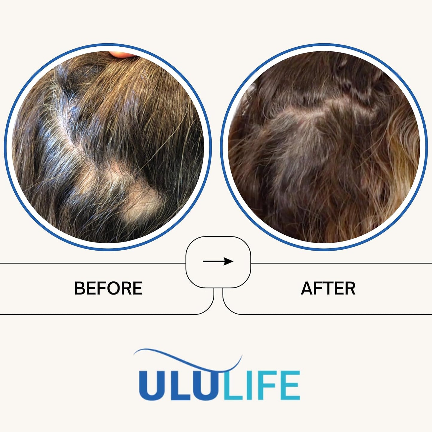 ULULIFE Ultimate Regrow Multivitamin - Promotes Hair Growth, Skin and Nails Health - Ashwagandha and Resveratrol-Powered - 540 Capsules (90-Day Supply) - görsel 3
