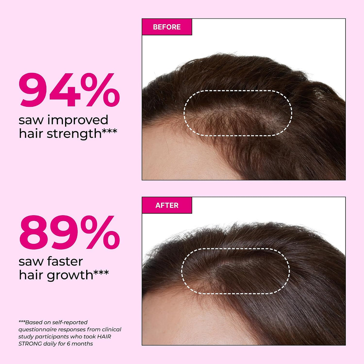 HUM Hair Strong Hair Support Gummies with Biotin, Zinc, Vitamin B12, Folic Acid - 60 Gummies - görsel 3