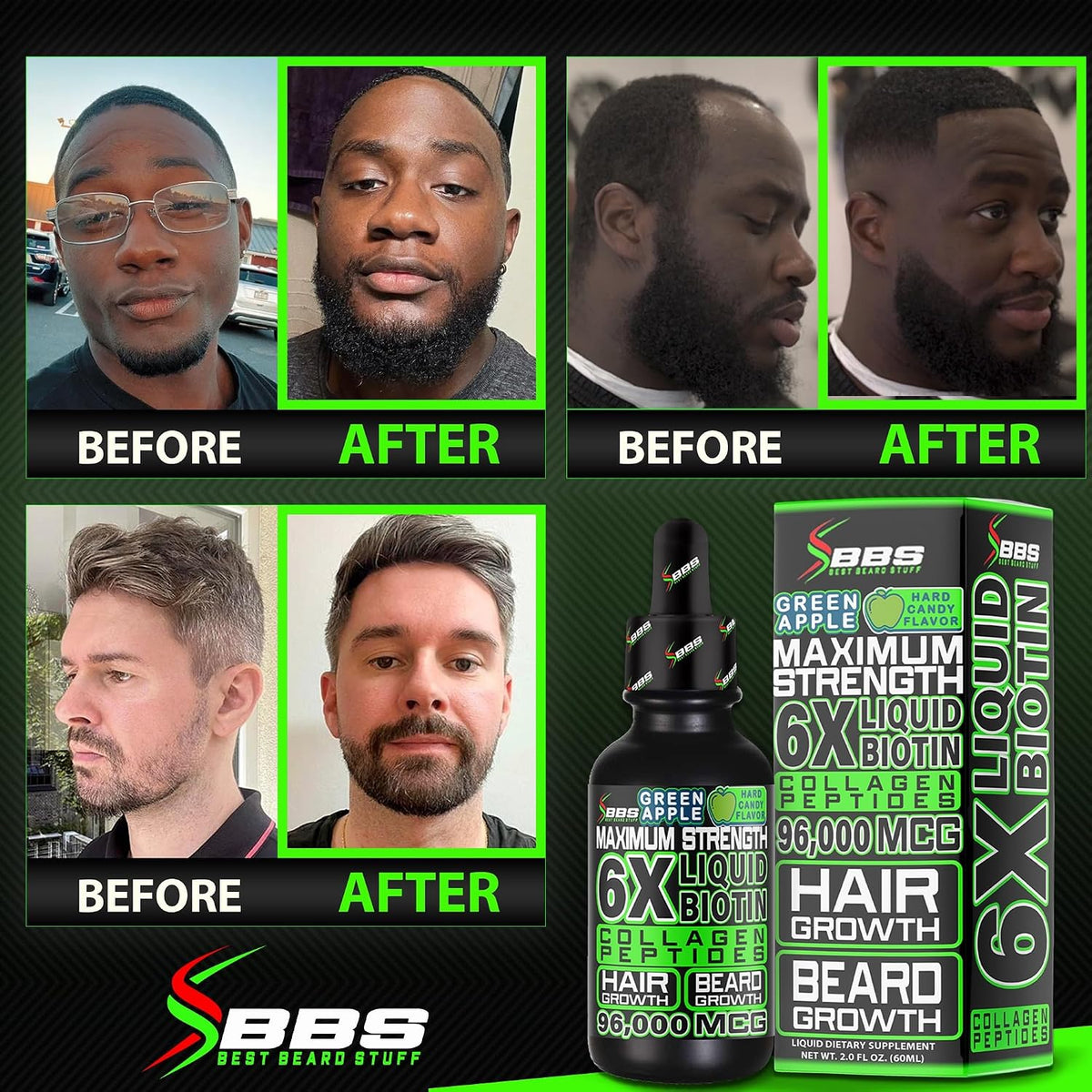 Liquid Biotin Collagen Peptides for Beard Growth and Thickening – Men's Hair Supplement - görsel 4