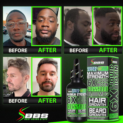 Liquid Biotin Collagen Peptides for Beard Growth and Thickening – Men's Hair Supplement