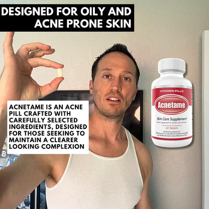 Acnetame Acne Tablets 2 Pack 120 Tablets – Vitamin Supplements for Breakouts
