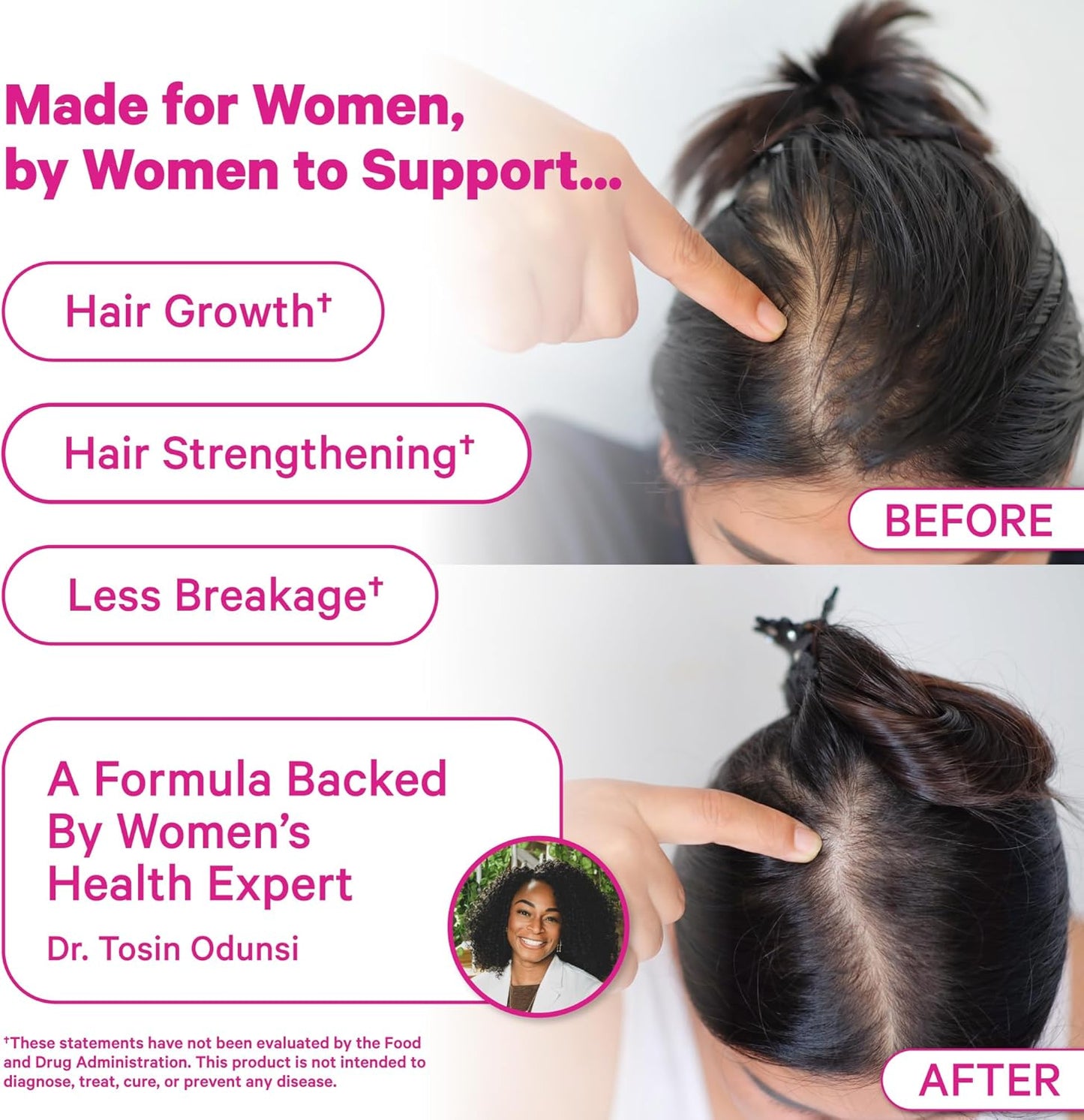 Pink Stork Postpartum Hair Loss Gummies - görsel 3